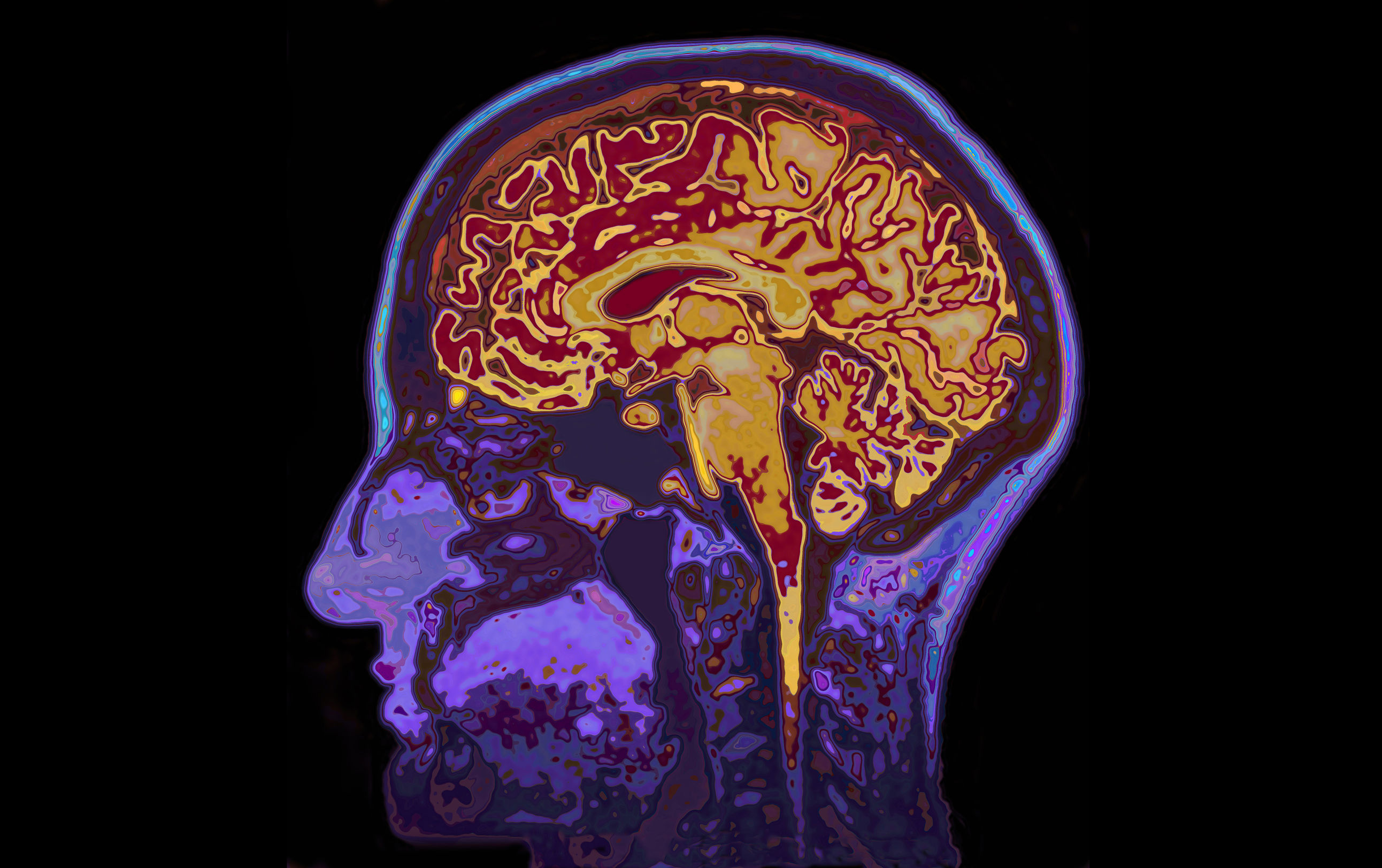 Fighting Dementia with ViewClix